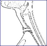 Hood Stoma 2
